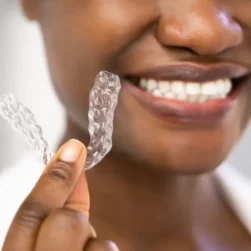 Active Aligners